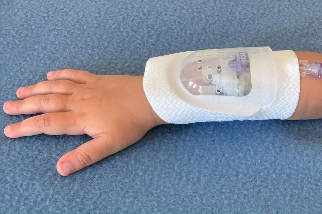 730Arm I.V. House UltraDressing protects I.V. insertion site on child's forearm