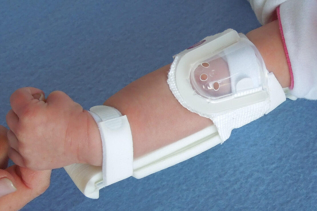 330M I.V. House UltraDressing on infant's elbow