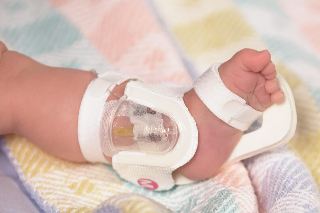 330M I.V. House UltraDressing on infant's ankle