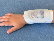 730Arm I.V. House UltraDressing protects I.V. insertion site on child's forearm
