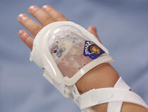 730S I.V. House UltraDressing protects I.V. insertion site on child's hand