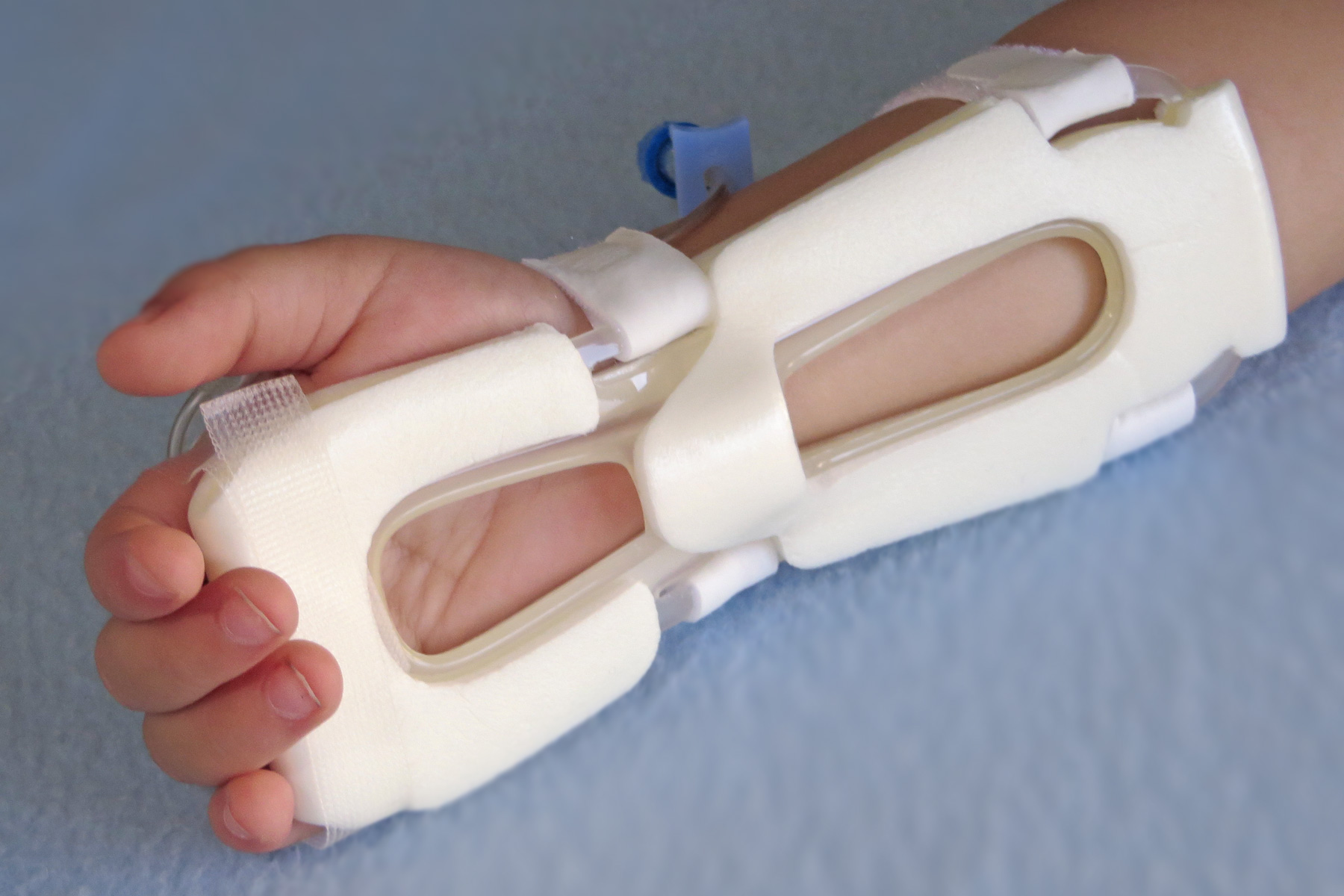939M-Ultra TLC Wrist Splint on toddler's wrist