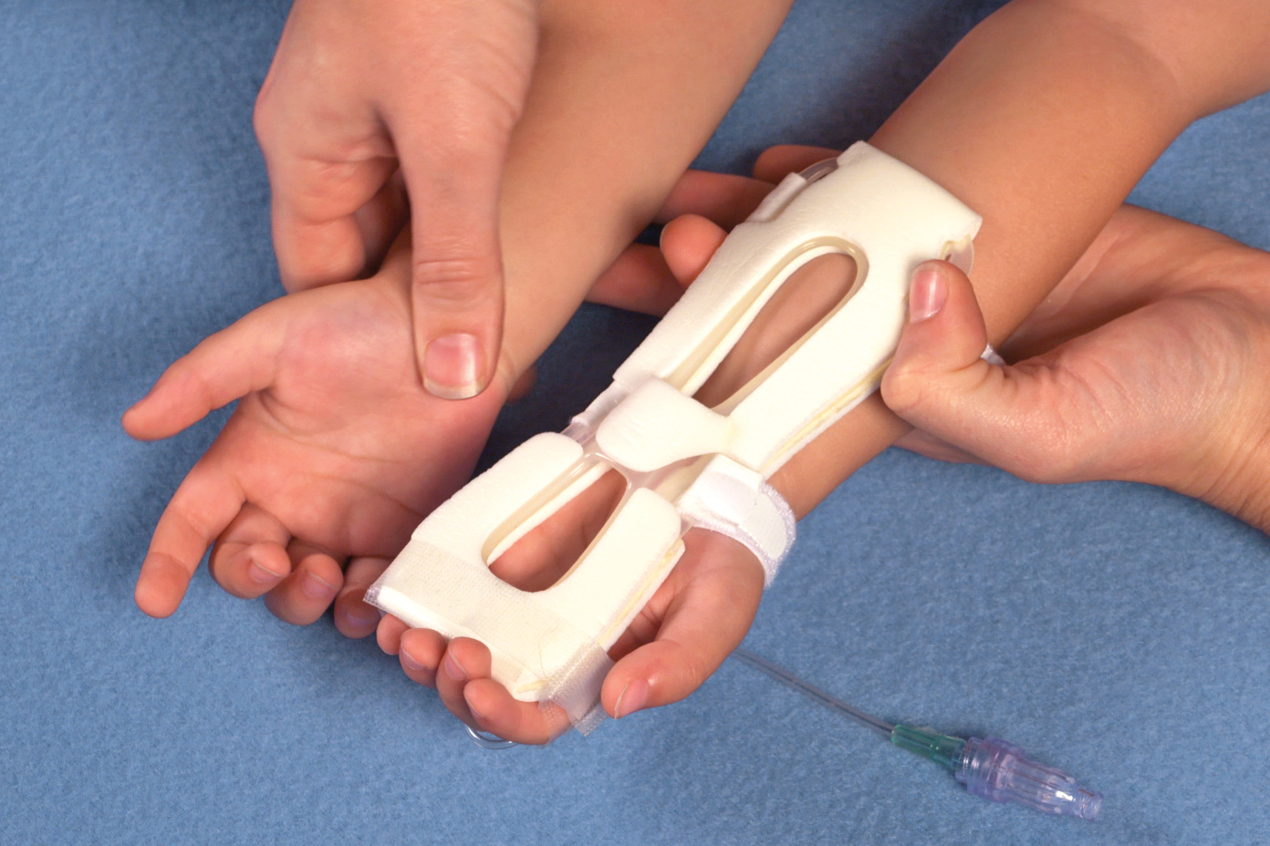 Comparing palmar side of hand and forearm with IV