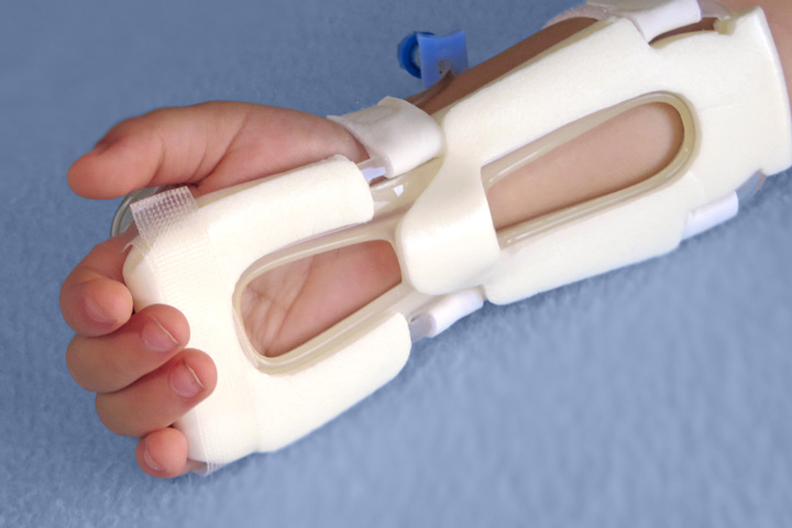 939S-Ultra TLC Wrist Splint on toddler