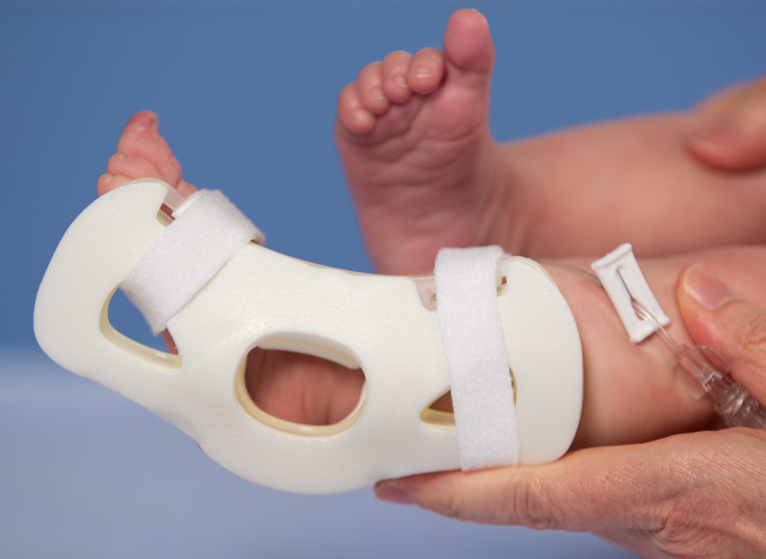 949SX IV House TLC Foot Splint on Infant's Foot