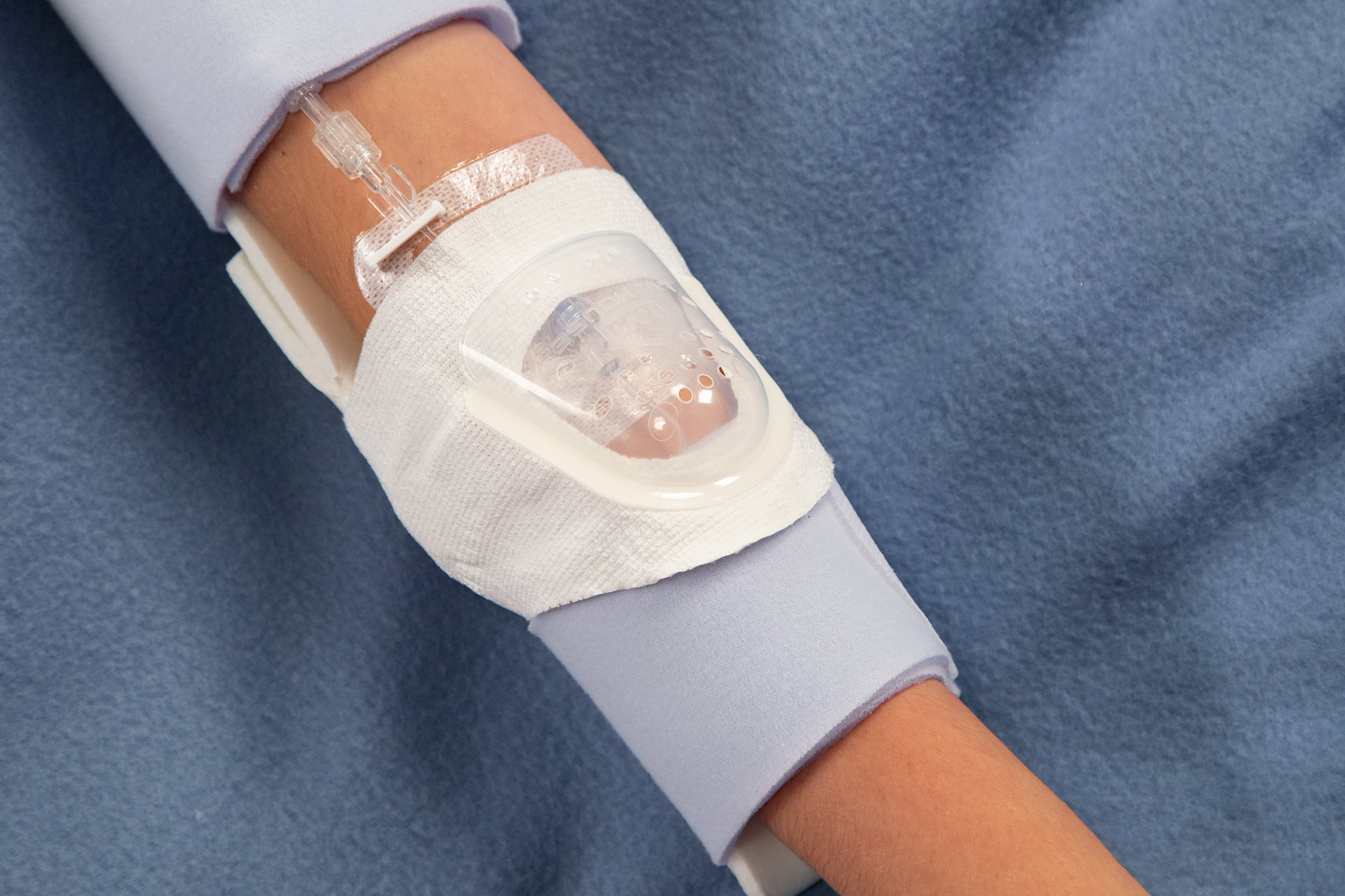TLC Elbow Splint for youths and adults