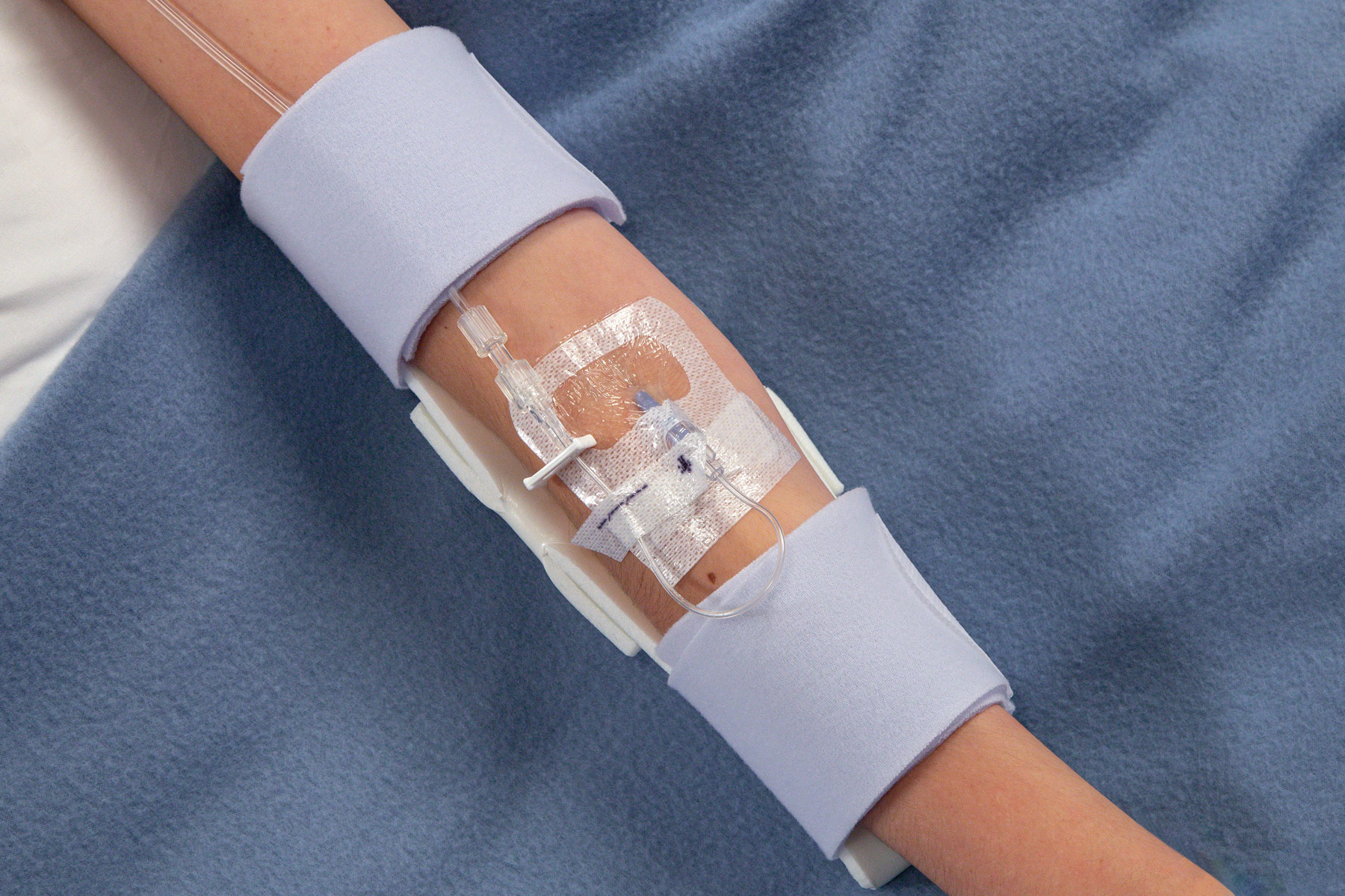 TLC Elbow Splint for youths and adults