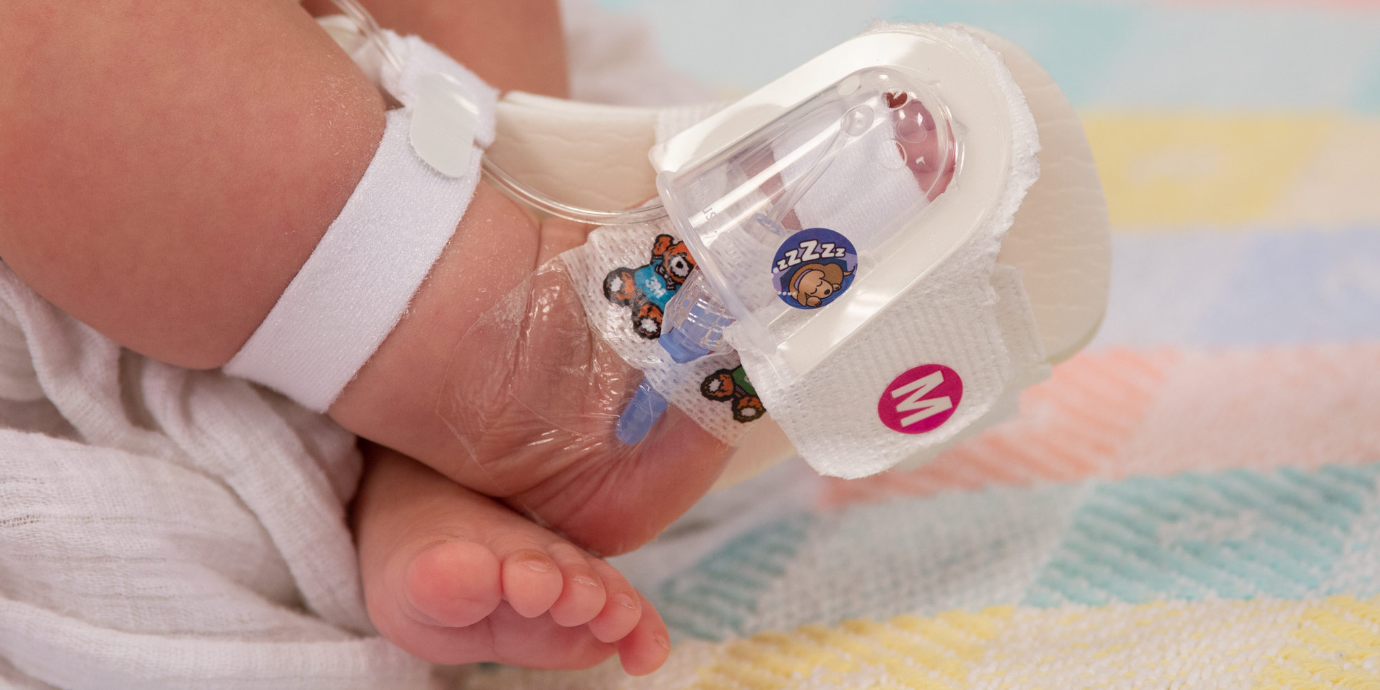 330M I.V. House UltraDressing protecting IV insertion site on infant's foot