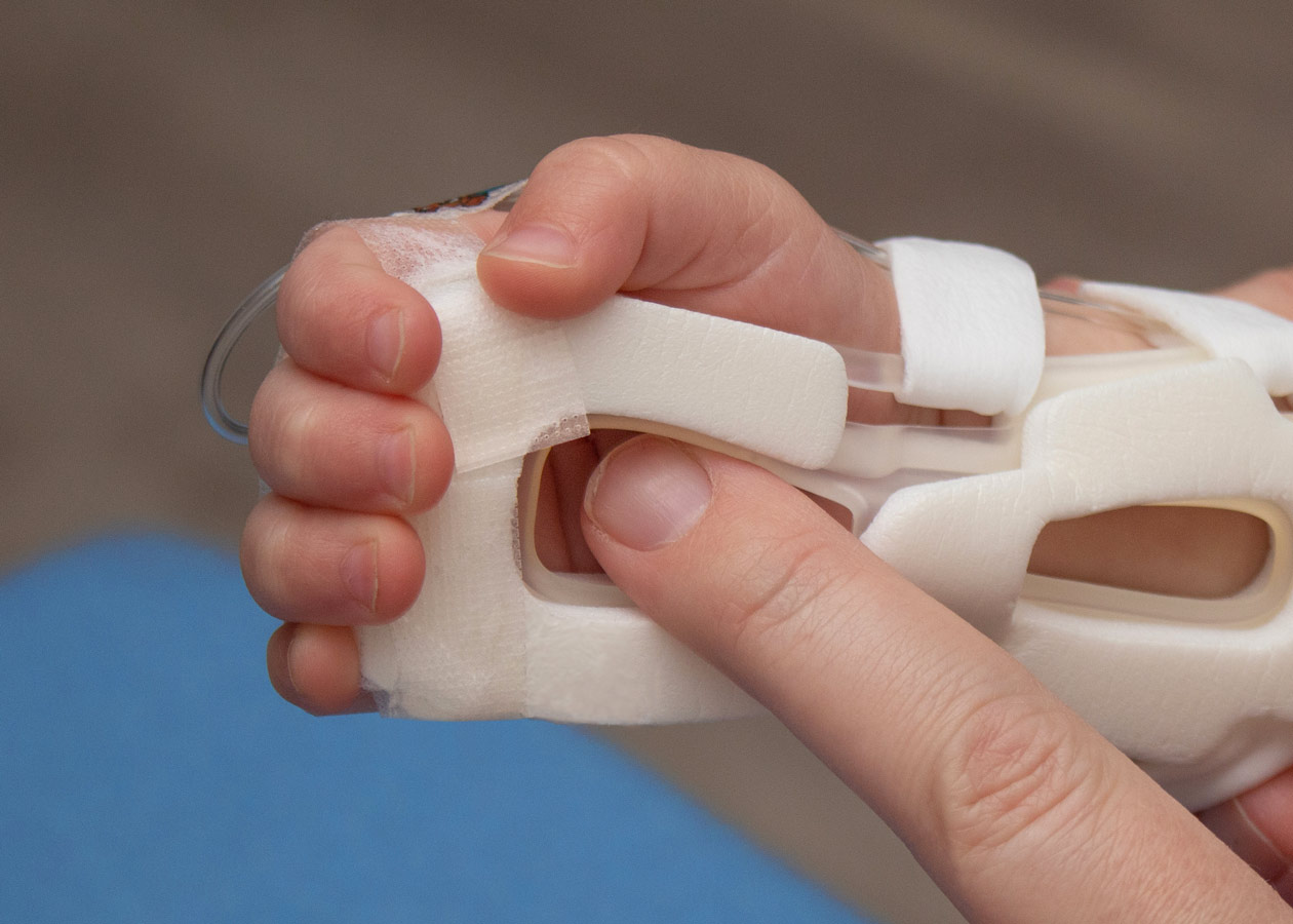 939S TLC Wrist Splint with tape