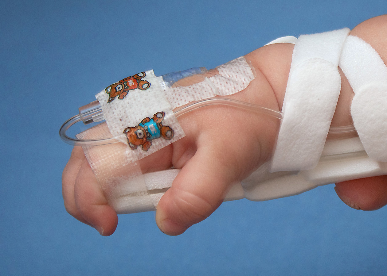 Tape at fingers secures TLC Wrist Splint for infants and toddlers