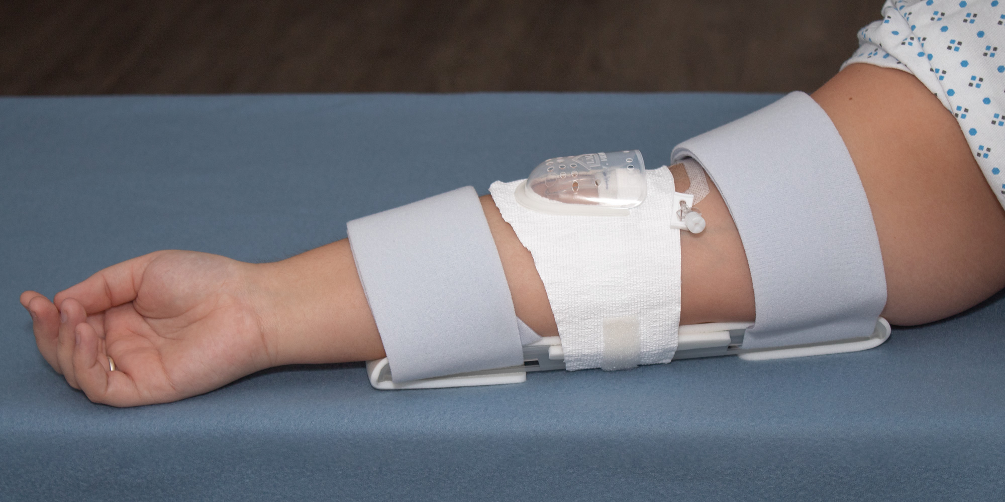 Extra-Large elbow splint and 730Arm I.V. House UltraDressing on patient's elbow