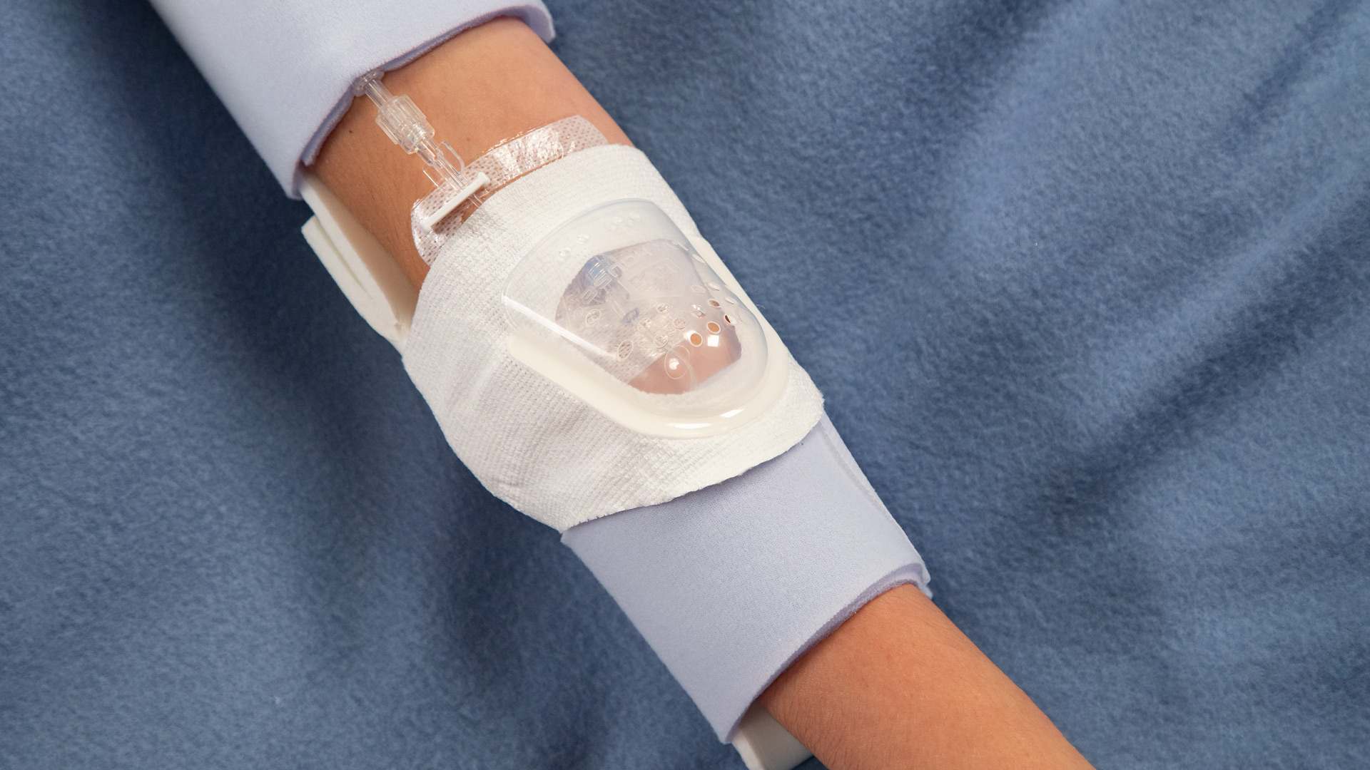 Extra-Large TLC Elbow Splint for youth through adults