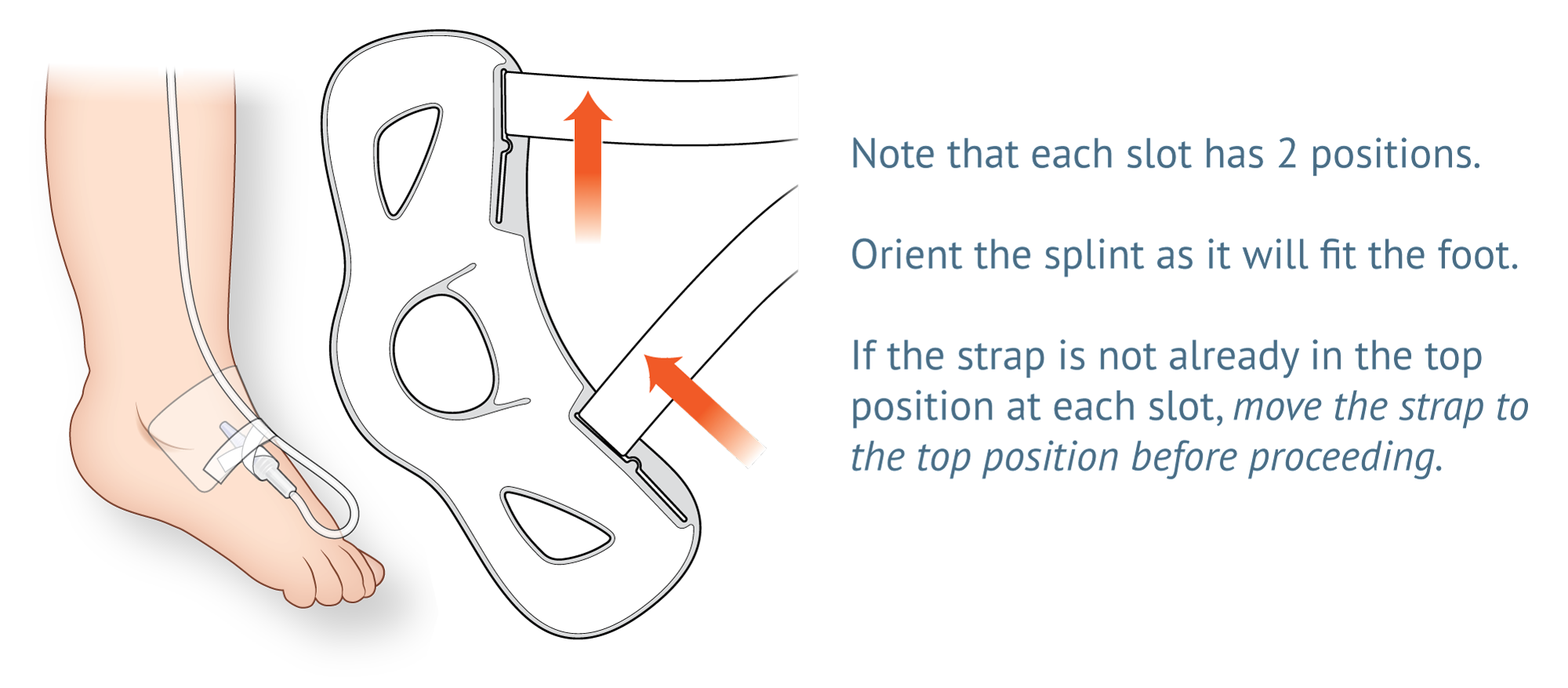Detail of 949S Foot Splint Tips and Tricks Sheet