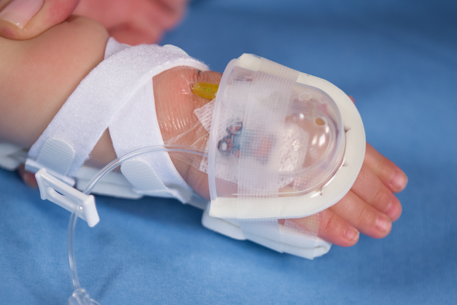 727SFP I.V. House UltraDome on infant's hand