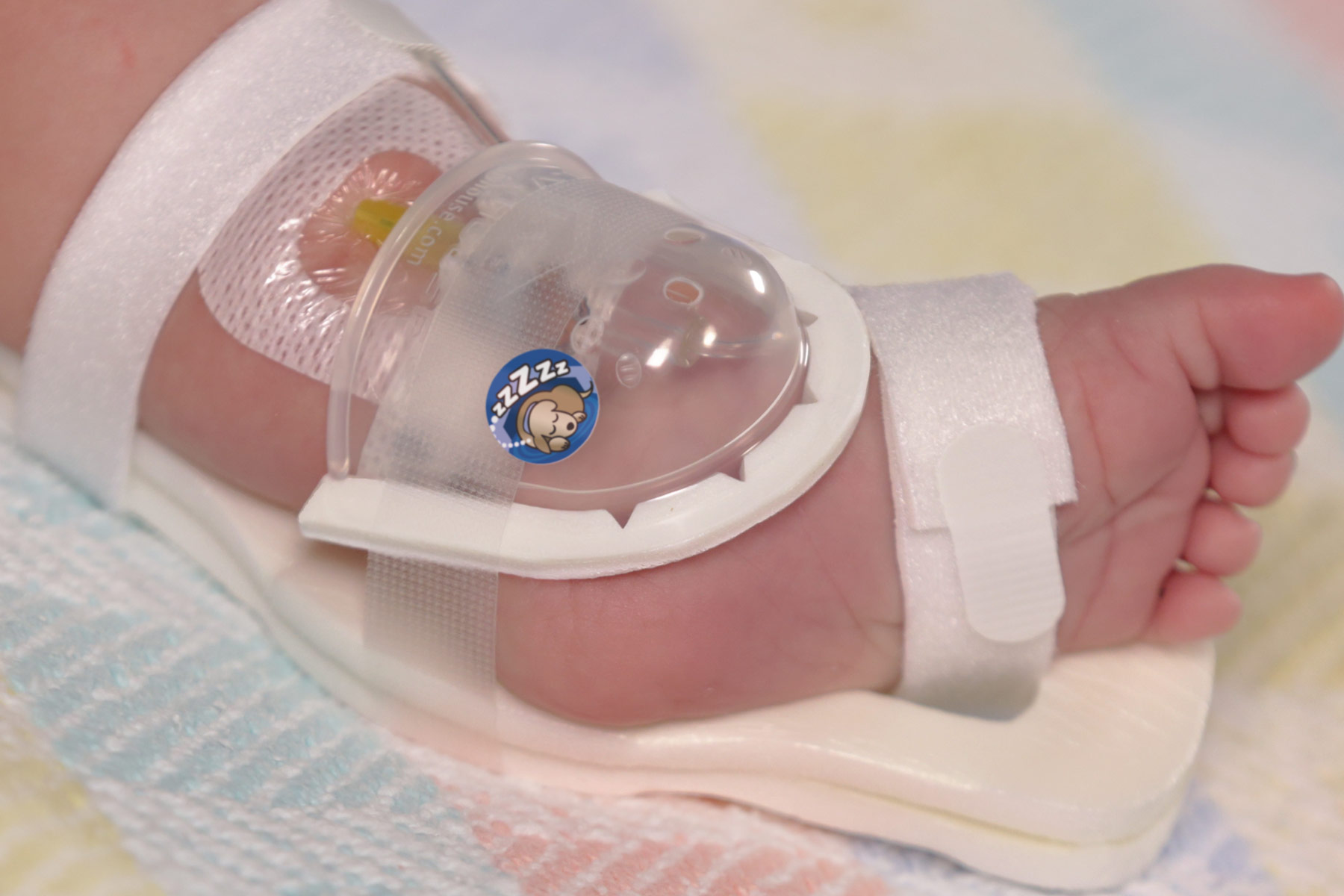 727SFP I.V. House UltraDome on infant's foot