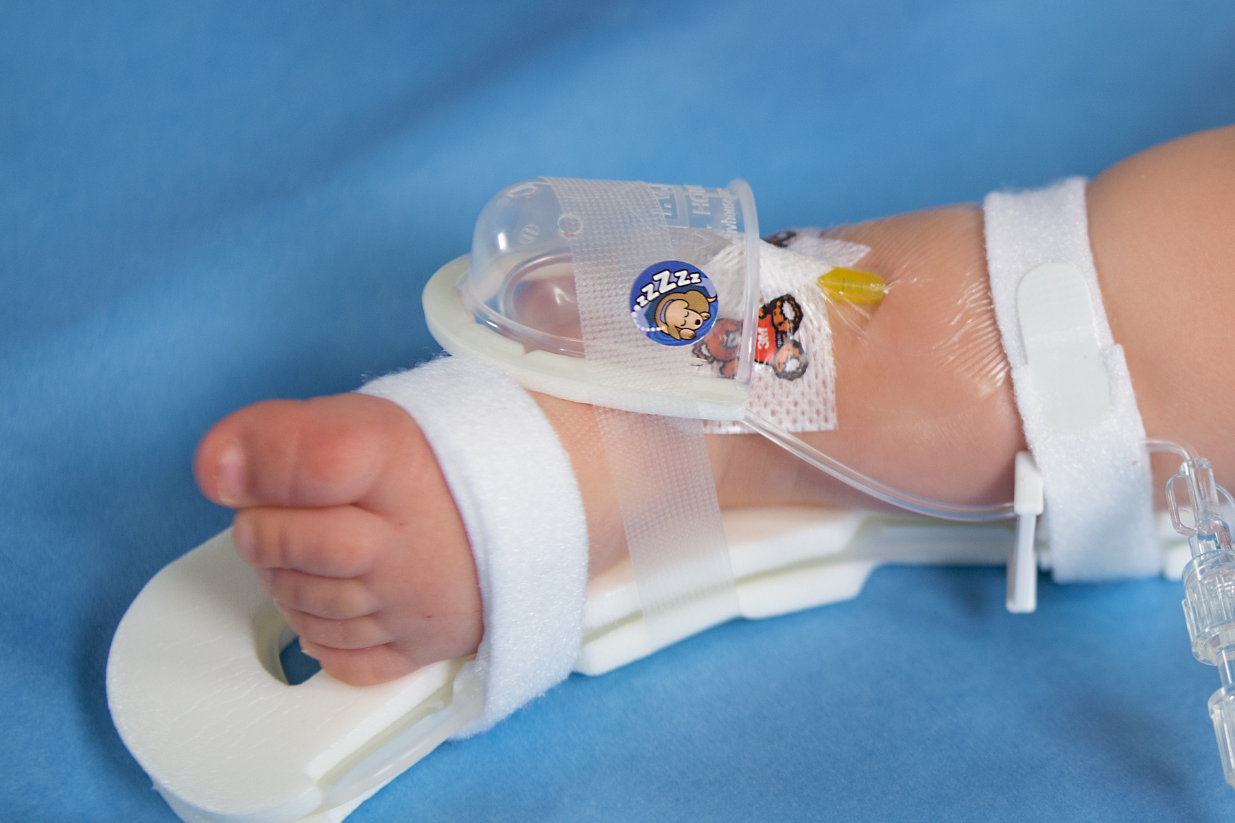 727SFP I.V. House UltraDome on infant's ankle