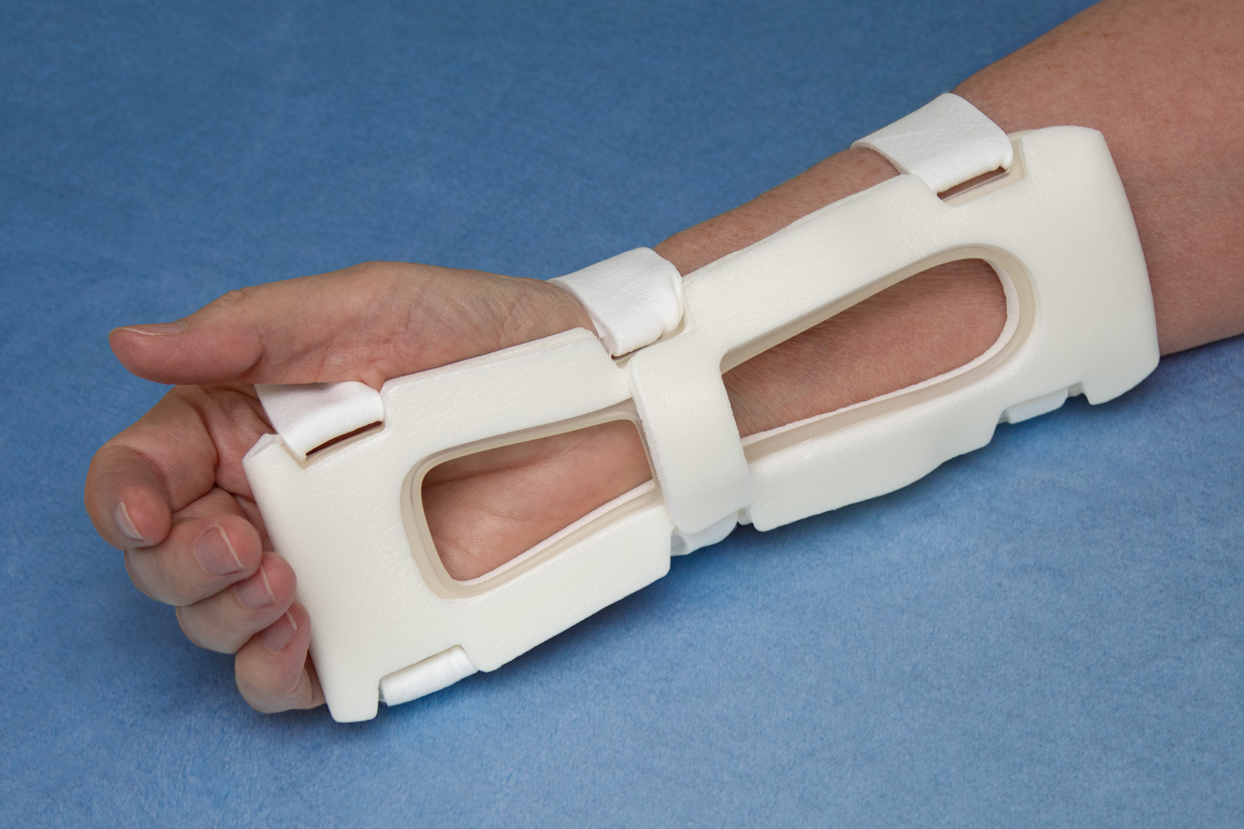 939XL-W-Ultra TLC Wrist Splint on adult's wrist
