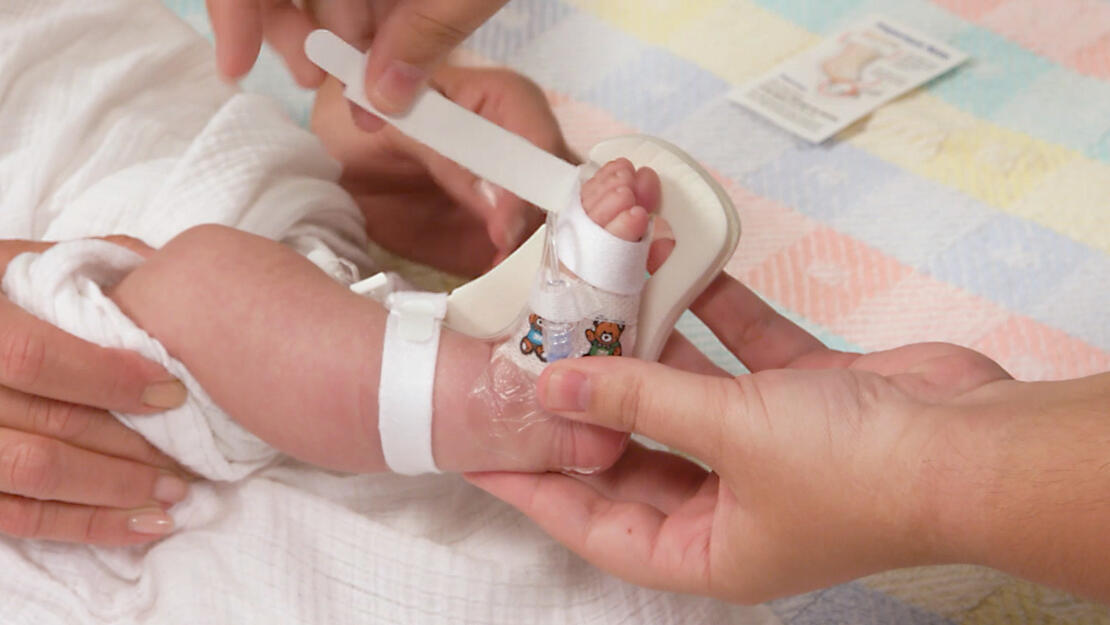 949XS TLC Splint with toe strap being applied