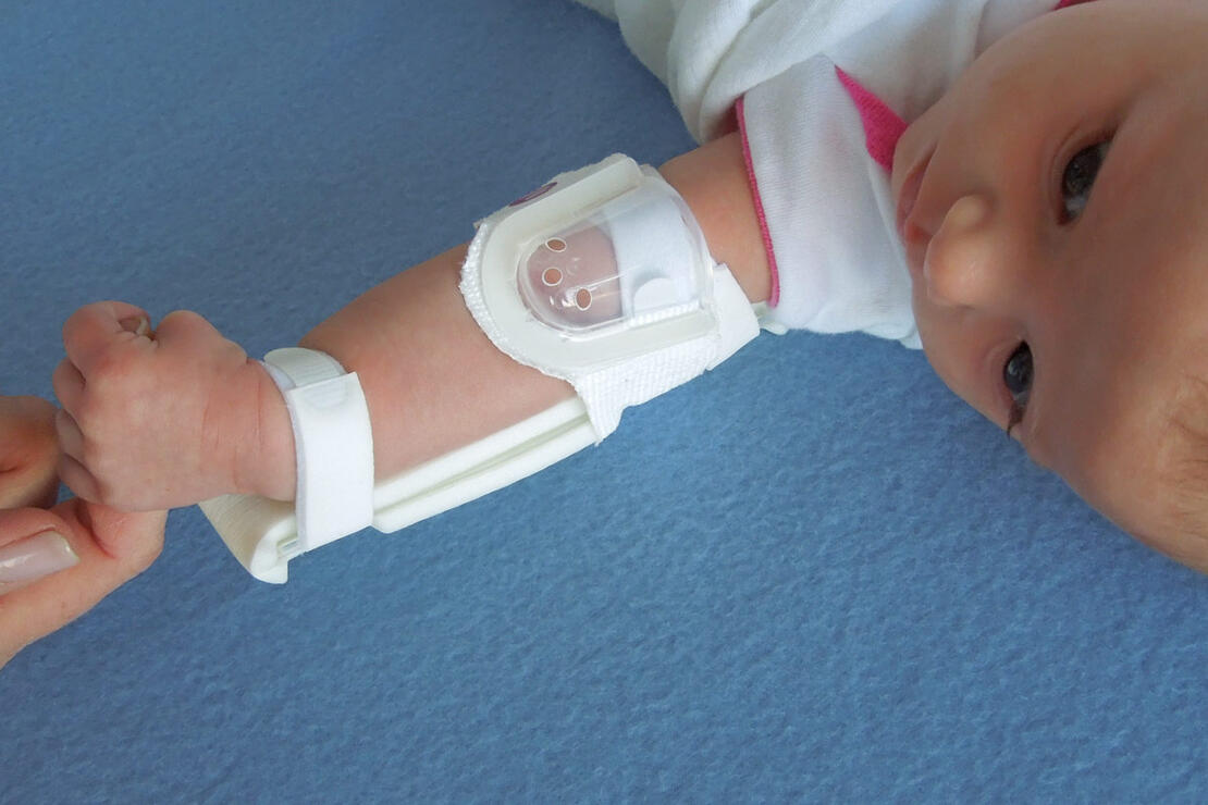 959XS-Ultra TLC Elbow Splint on infant's elbow