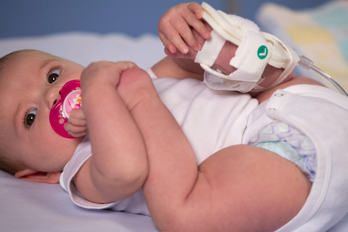 949XS TLC Foot Splint on infant