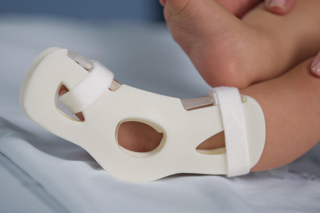 949S TLC Foot Splint on infant
