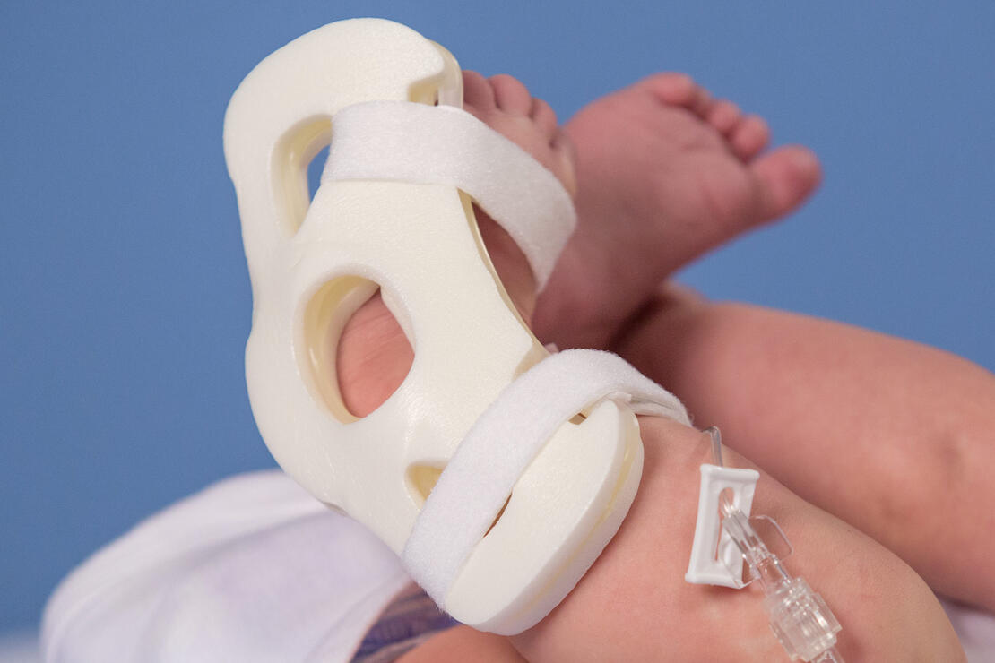 949XS TLC Foot Splint on infant