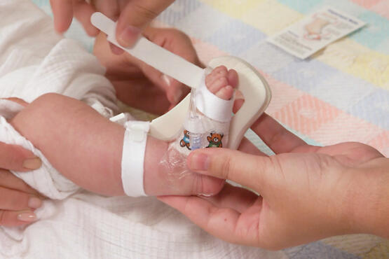 949XS TLC Splint with toe strap being applied