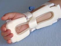 939M-Ultra TLC Wrist Splint on toddler's wrist