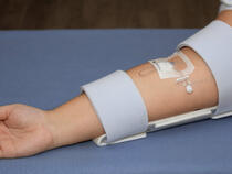 959XL TLC Elbow Splint for older children up to average adults