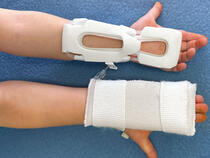 I.V. House TLC Splint vs. Traditional Armboard