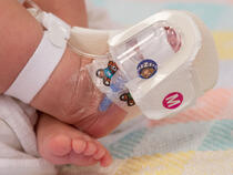 949S TLC Foot Splint and 330M I.V. House ultraDressing on Infant's foot