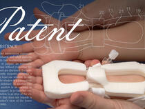 TLC Splint has received a patent