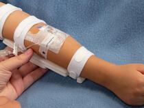 Prevent IV Site Complications