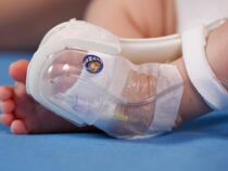 949XS TLC Foot Splint and 330L I.V. House UltraDressing on infant