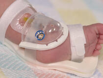 727SFP I.V. House UltraDome on infant's foot