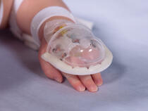 727SFP I.V. House UltraDome on infant's hand