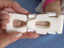 939S-Ultra TLC Wrist Splint, assessing underside of infant's wrist
