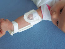 959XS-Ultra TLC Elbow Splint on infant's elbow