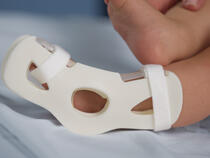 949S TLC Foot Splint on infant