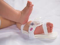 949S TLC Foot Splint and 330M I.V. House UltraDressing on infant