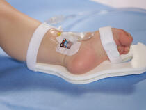 949S TLC Foot Splint on infant