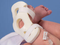 949XS TLC Foot Splint on infant