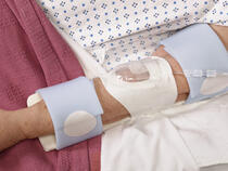 959XL-Ultra TLC Elbow Splint with 730Arm I.V. House UltraDressing on adult's elbow