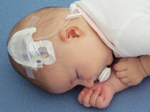 727SFP I.V. House UltraDome on infant's scalp