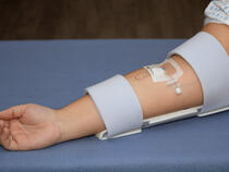 959XL-Ultra TLC Elbow Splint on adult's elbow