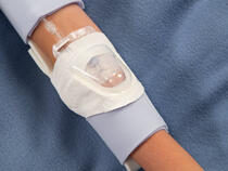 959XL-Ultra TLC Elbow Splint with 730Arm I.V. House UltraDressing on youth 