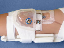 330L I.V. House UltraDressing on toddler's elbow